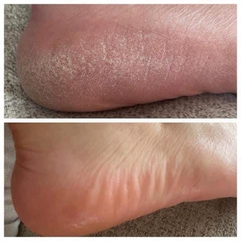 Pedicure in a bottle - Picture 2 of 9